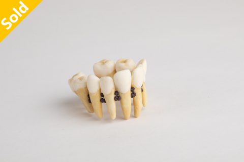 吞噬（英喆）